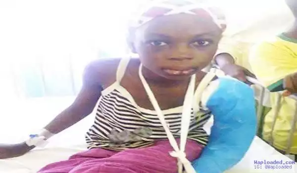 Photo: Wicked Stepmother Tortures 10-Year-Old Girl With Fire